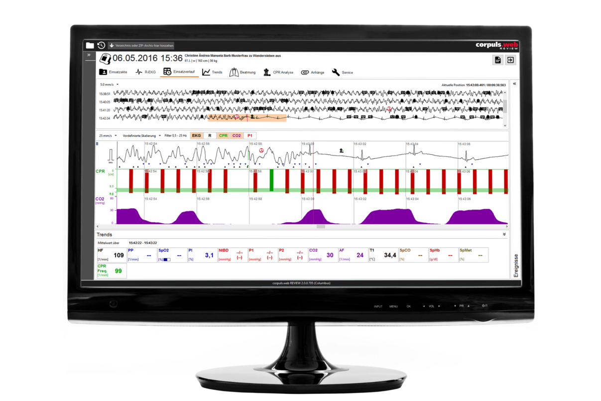 corpuls.web REVIEW